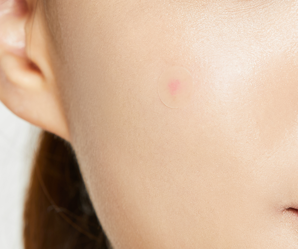 COSRX Acne Pimple Master Patch2_kimmi.png